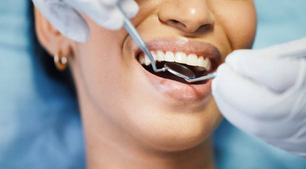 Best Knocked-Out Tooth Emergency  in Lindenhurst, NY